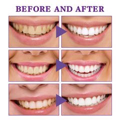 V34 Brightening Tooth Mousse